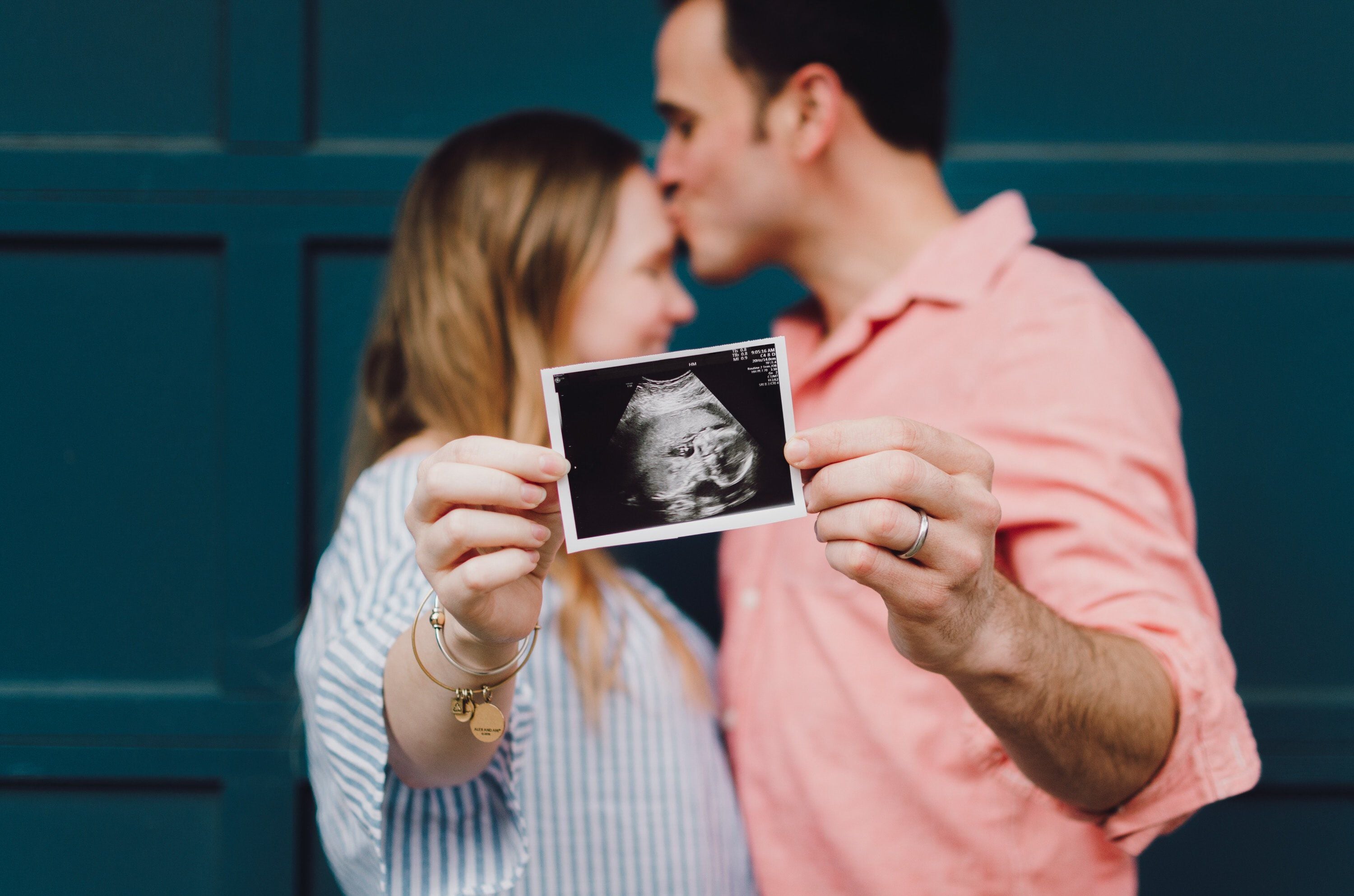 sonogram picture